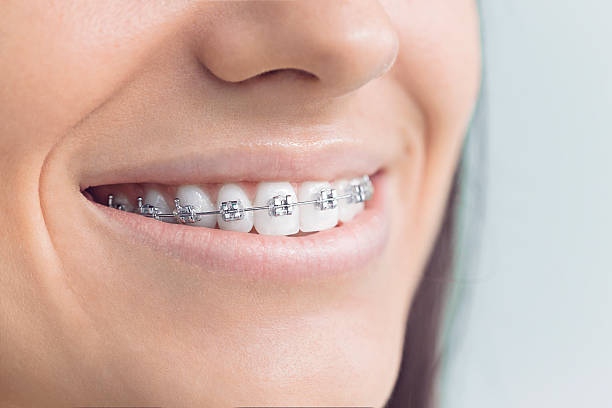 Best Tooth Extraction  in San Antonio, TX